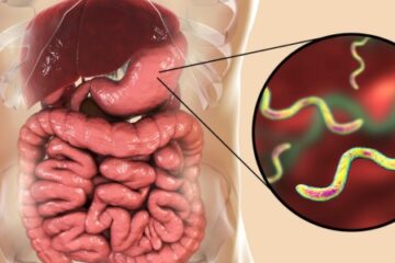 「ピロリ菌で胃がんになるのは炎症が原因」記事内の画像