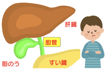 「胆管がんのステージ4とは？生存率や治療法など詳しく解説」記事内の画像