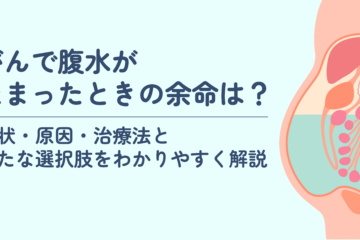 「がんで腹水がたまったときの余命は？症状・原因・治療法と新たな選択肢をわかりやすく解説」記事内の画像