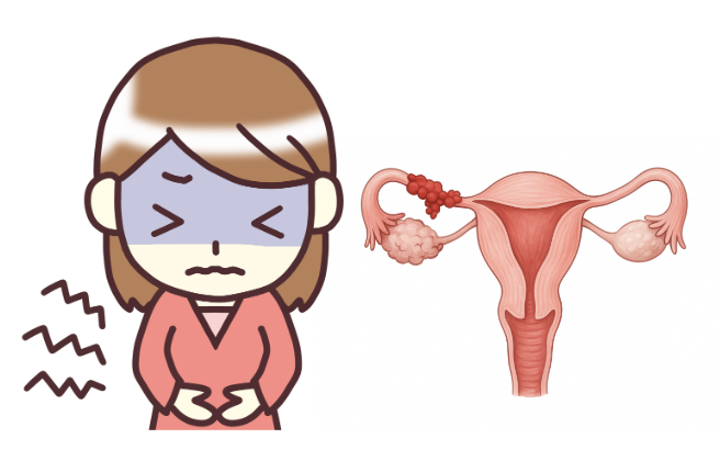 卵管がん　末期