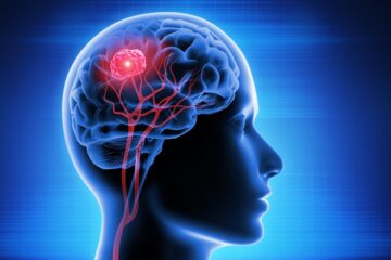 「フェロトーシスを介した脳腫瘍治療におけるNUAK2の役割」記事内の画像