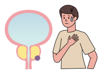 「前立腺がんのステージ3とは？　症状や生存率、治療法について解説」記事内の画像