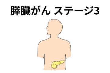「膵臓がんのステージ3とは？症状、治療法、生存率、再発リスクなど解説」記事内の画像