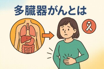 「多臓器がんとは？　重複がん・多重がん・多発がんとの違いや治療法について解説」記事内の画像
