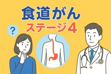 「食道がんのステージ4とは？治療法や余命・生存率について解説」記事内の画像