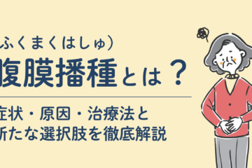 「腹膜播種（ふくまくはしゅ）とは？症状・原因・治療法と新たな選択肢を徹底解説」記事内の画像