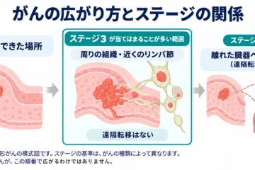 「がんのステージ3とは？3A・3B・3Cの違いと部位別の5年生存率」記事内の画像