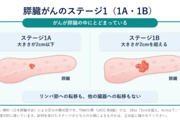 「膵臓がんのステージ1とは？余命の目安・再発・完治をめざす治療」記事内の画像